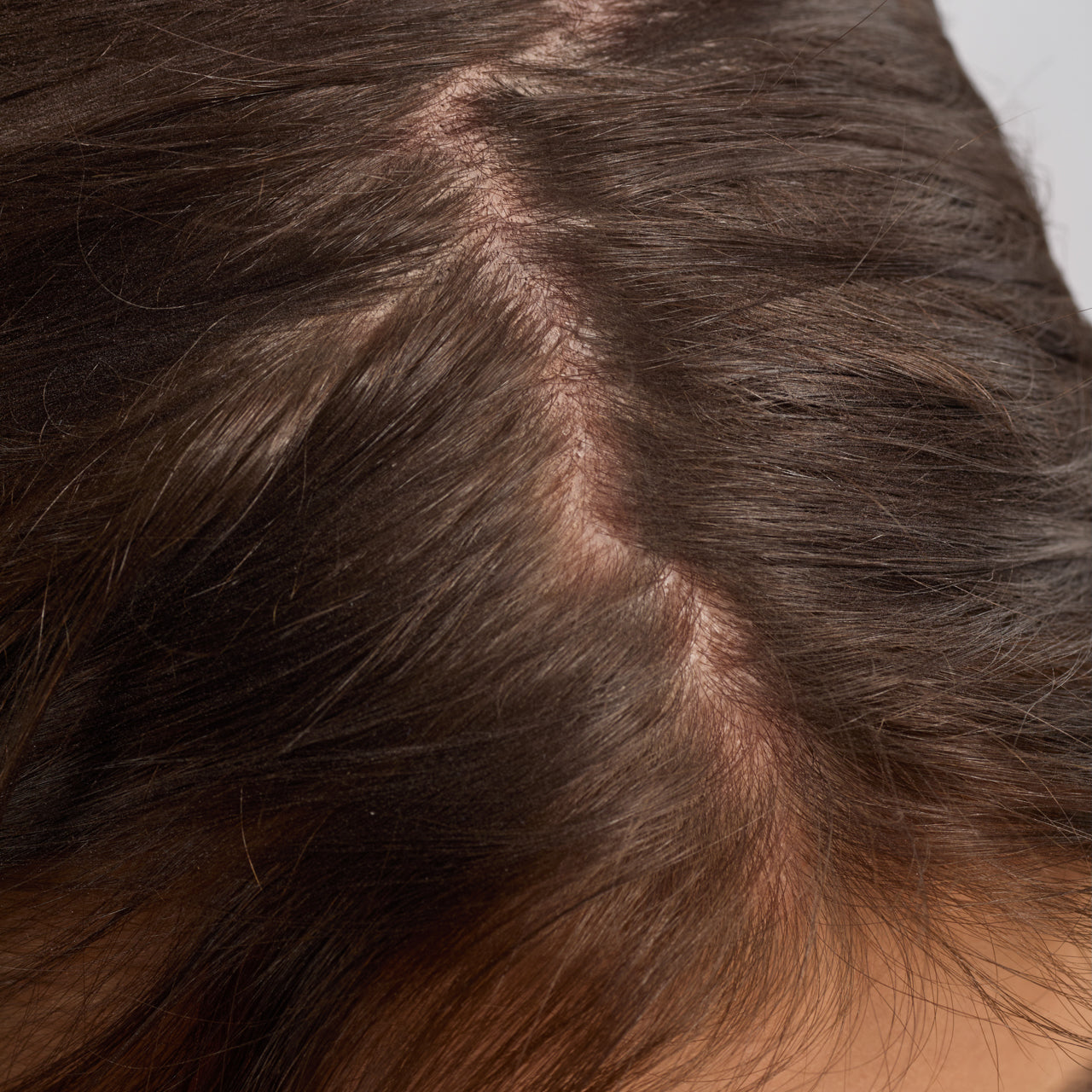 Strengthening Rosemary & Biotin Scalp & Hair Oil 3 Pack - Image 6